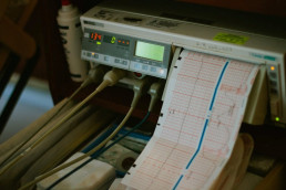 An ECG machine reads 134