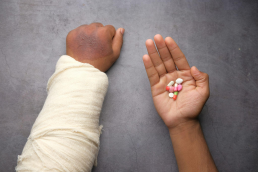 A person with a broken hand