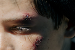 a close-up shot of an injured person with wounds on their cheek and eyebrow